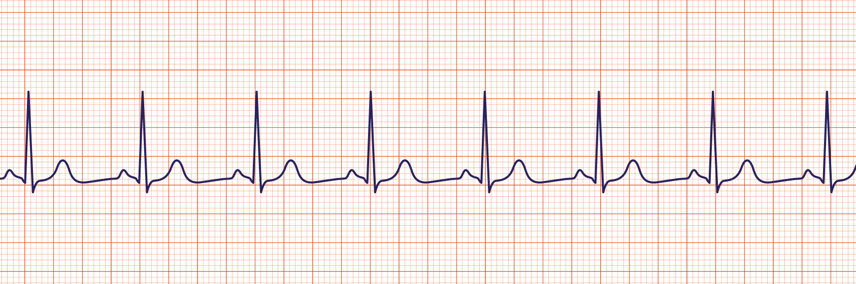 ACLS-Figure-22