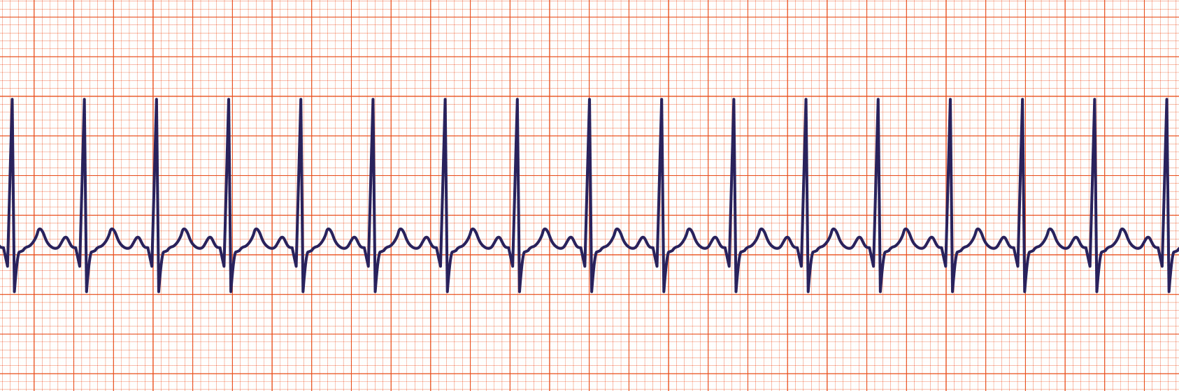 ACLS-Figure-24