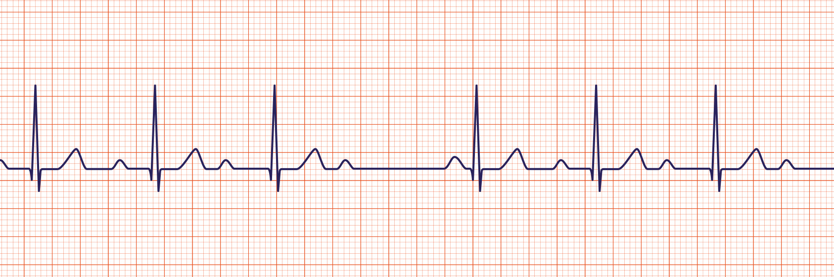 ACLS-Figure-26