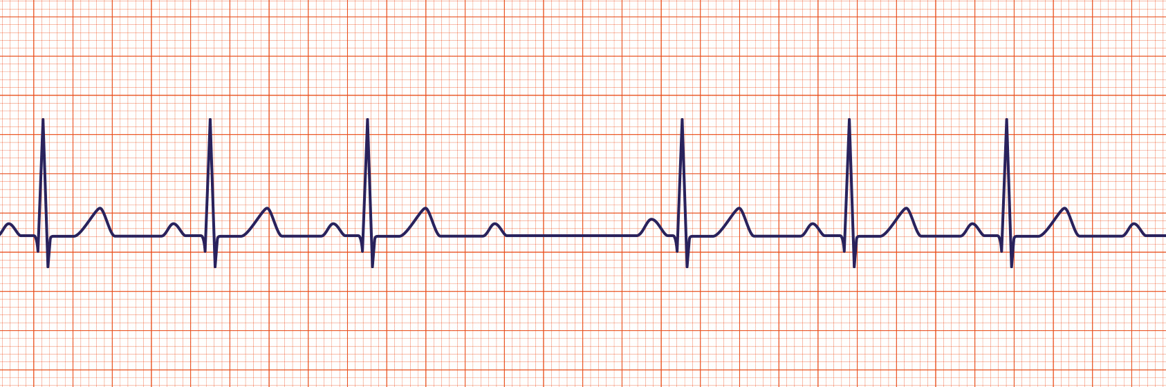 ACLS-Figure-27