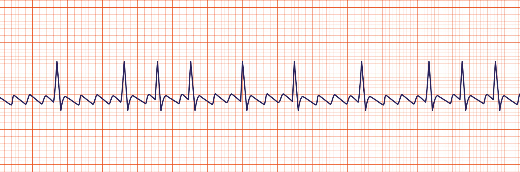 ACLS-Figure-31