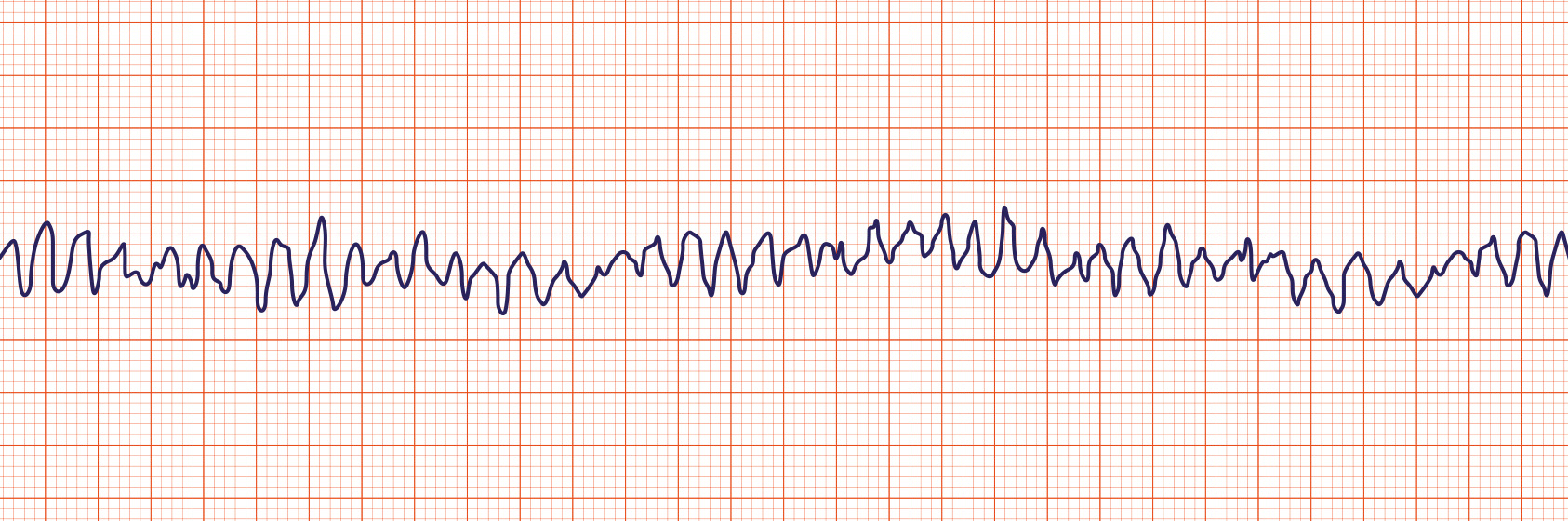 ACLS-Figure-33