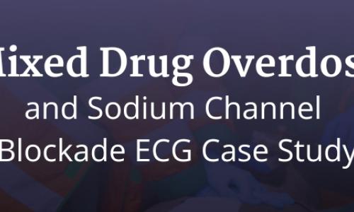 Mixed Drug Overdose and Sodium Channel Blockade ECG Case Study