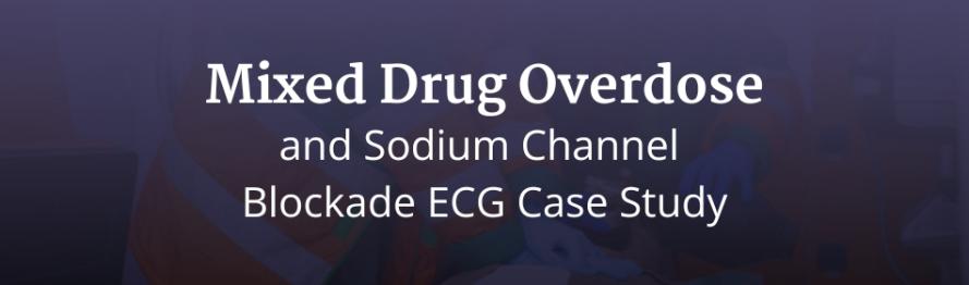 Mixed Drug Overdose and Sodium Channel Blockade ECG Case Study