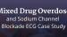Mixed Drug Overdose and Sodium Channel Blockade ECG Case Study