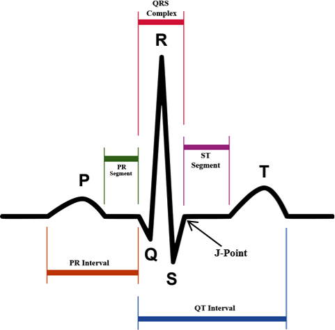 Ecg Chart Labeled