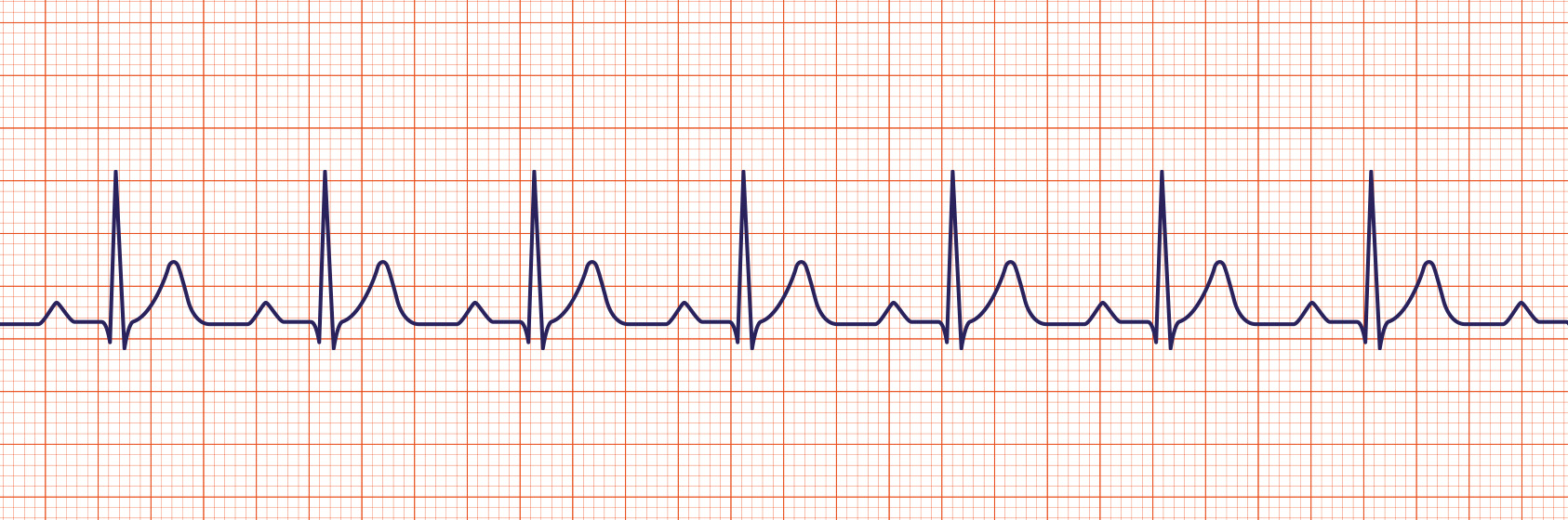 ACLS-Figure-25.jpg